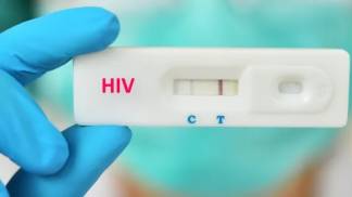TESTE RÁPIDO HIV