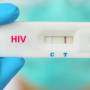 SES-MT alerta sobre importância da testagem rápida contra o HIV
