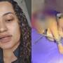 Mulher que ficou 5 dias acorrentada em cativeiro revela tortura com ácido: queimada por dentro